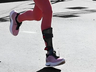 کاربن AFO منحنی خطوط وحدانی کیا ہیں؟